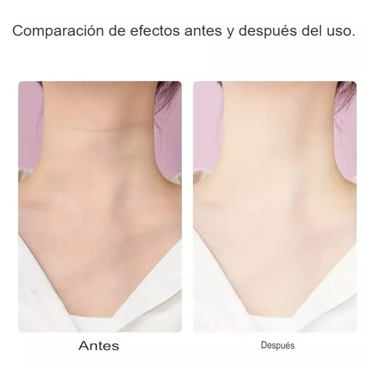 Equipo Rejuvenecedor Facial Y De Cuello
