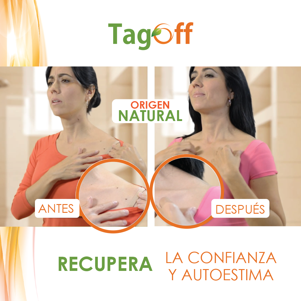 Tabs Off Elimina Verrugas
