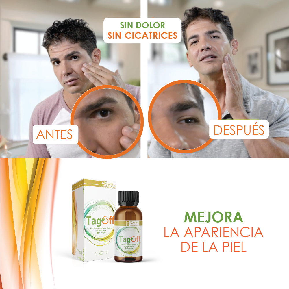 Tabs Off Elimina Verrugas
